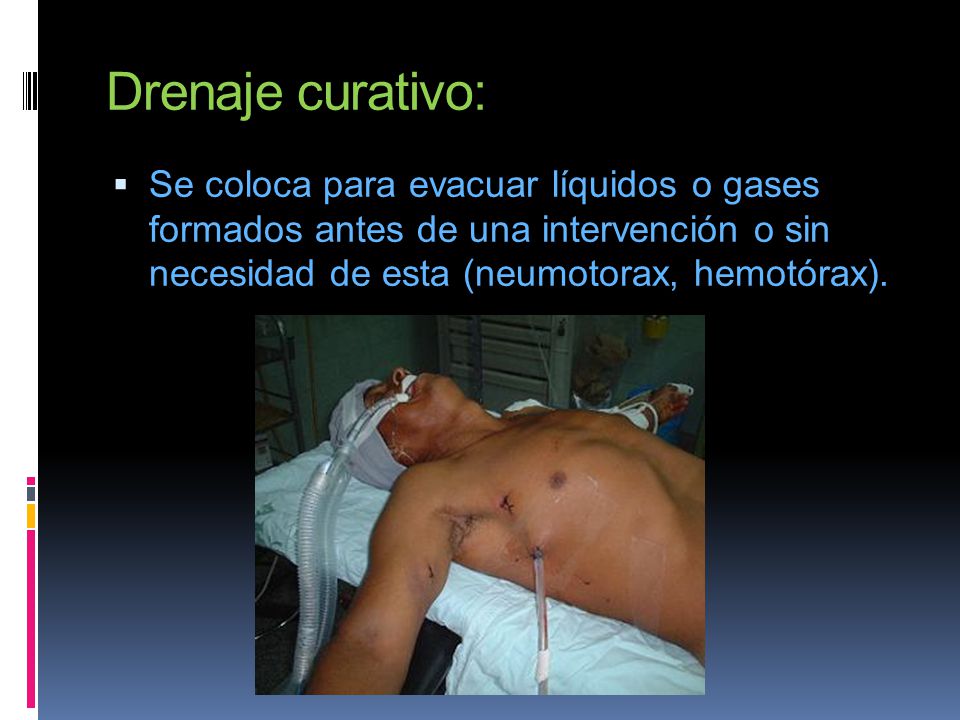 Drenaje de liquidos new arrivals